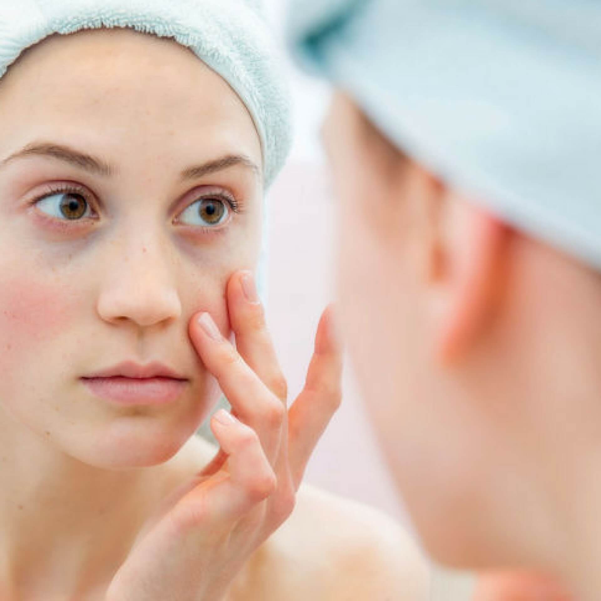 Effect of zinc gluconate on propionibacterium acnes resistance to erythromycin in patients with inflammatory acne: in vitro and in vivo study