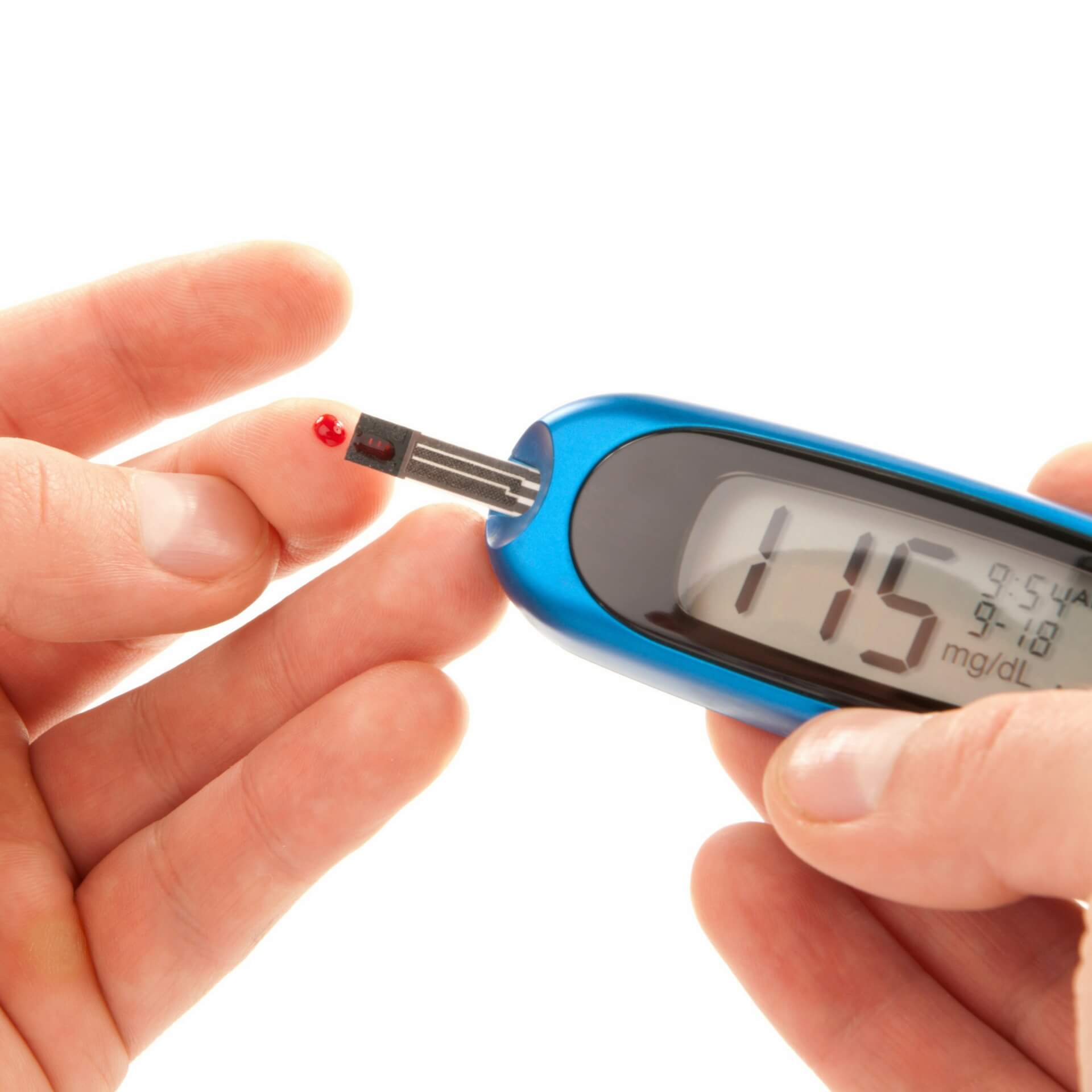 Hypovitaminosis D in Patients with Type 2 Diabetes Mellitus: A Relation to Disease Control and Complications