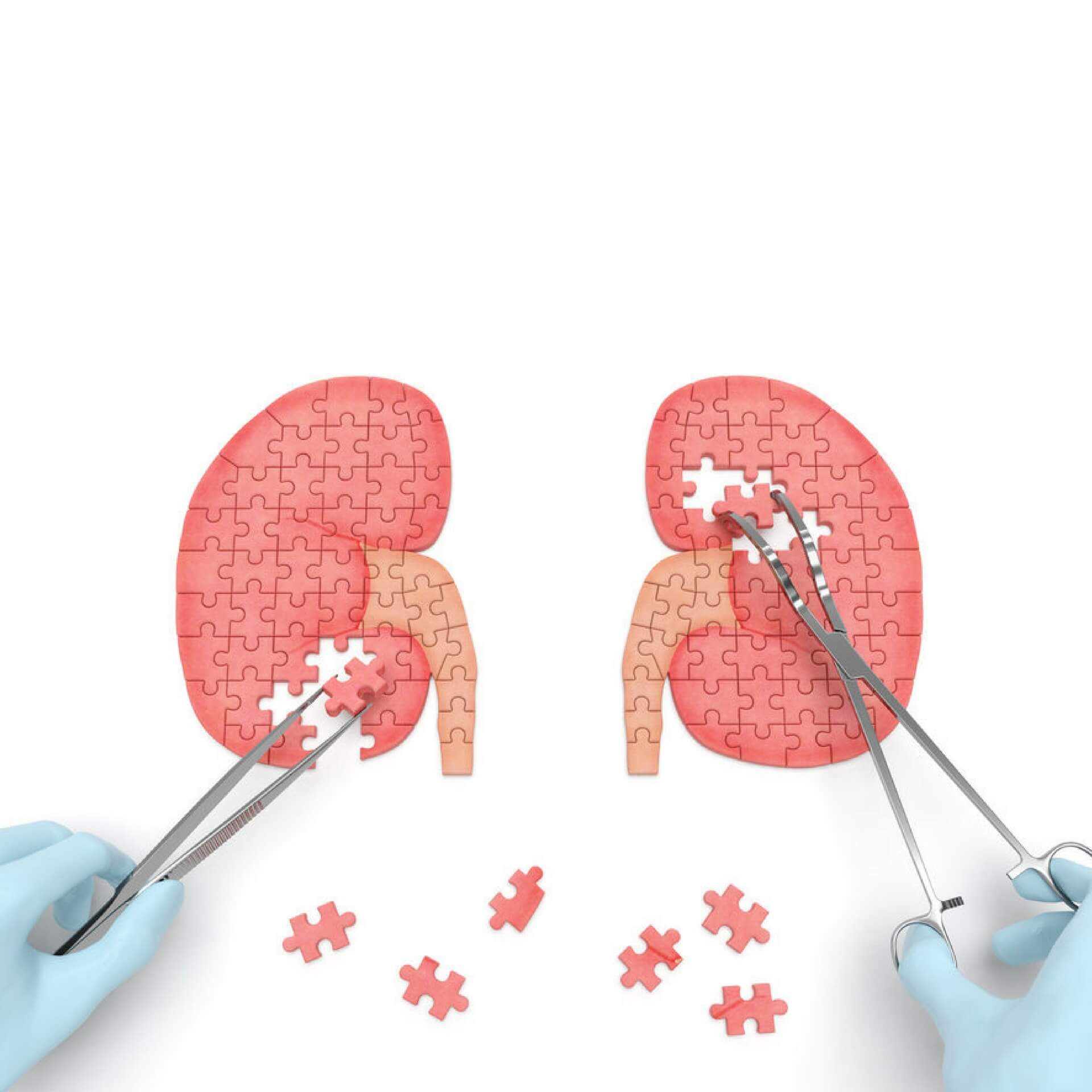 Vitamin Supplements for Kidney Disease