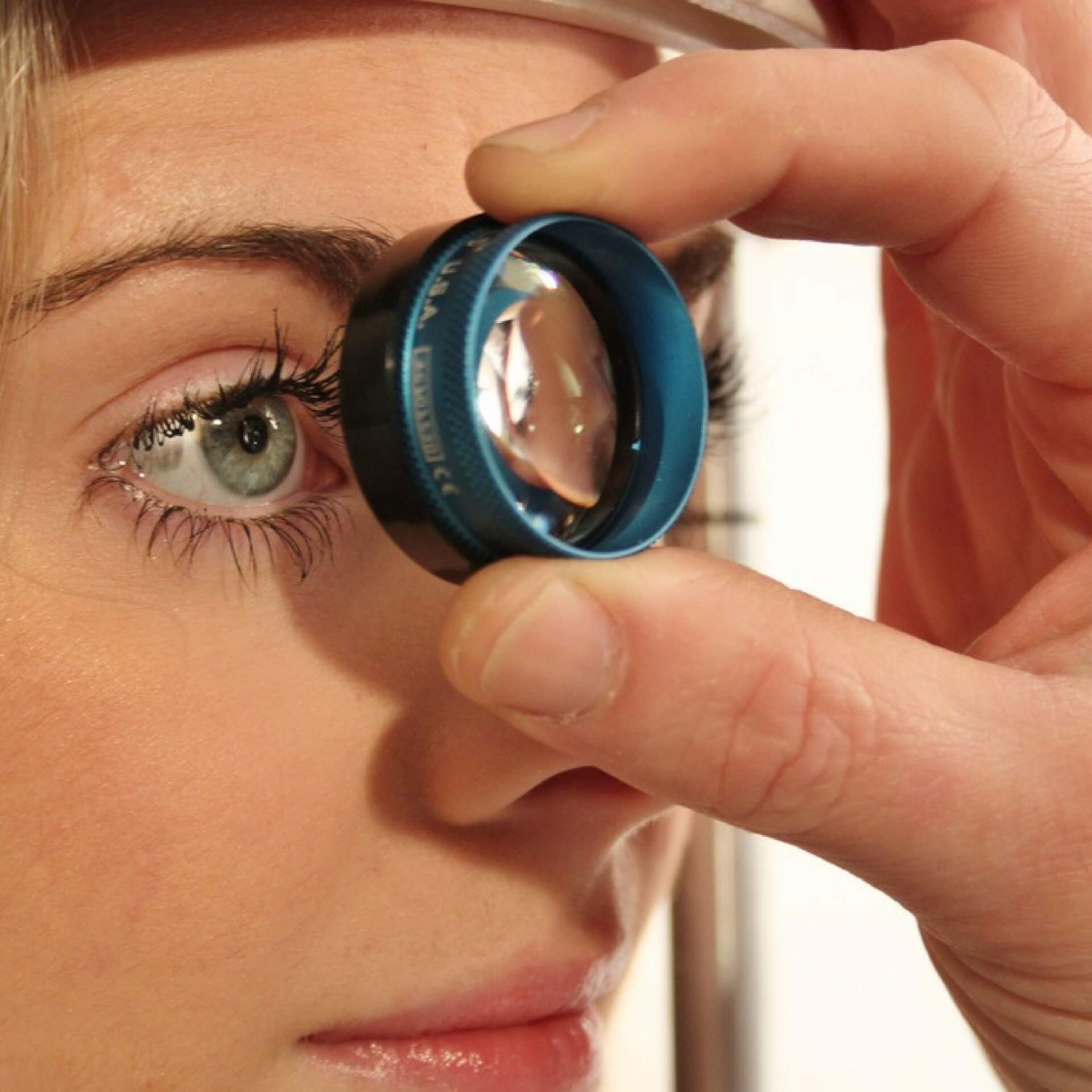 Ginkgo biloba: An adjuvant therapy for progressive normal and high tension glaucoma